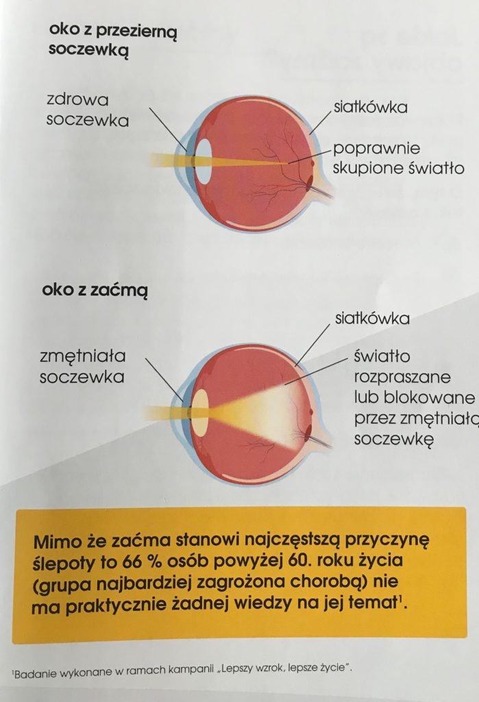 zdj%C4%99cie-zac2-699x1024.jpg